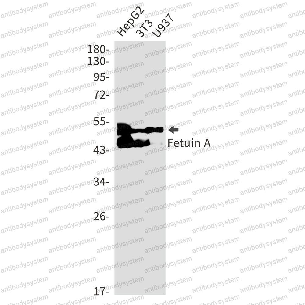 Anti-AHSG Antibody (R1J12)