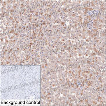 Anti-AHSG Antibody (R2Y15)