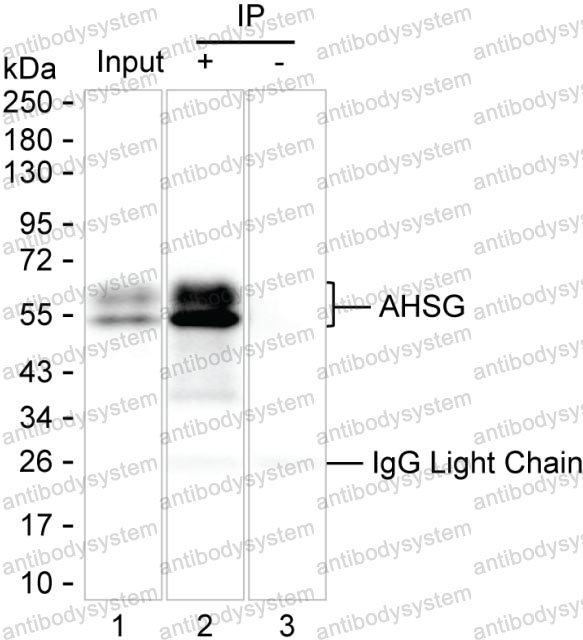Anti-AHSG Antibody (R2Y16)