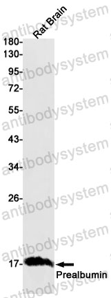 Anti-TTR/Prealbumin/Transthyretin Antibody (R1J13)