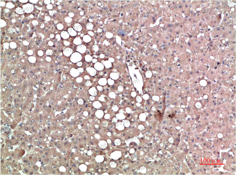 Anti-TTR/Prealbumin/Transthyretin Antibody (R2Y19)