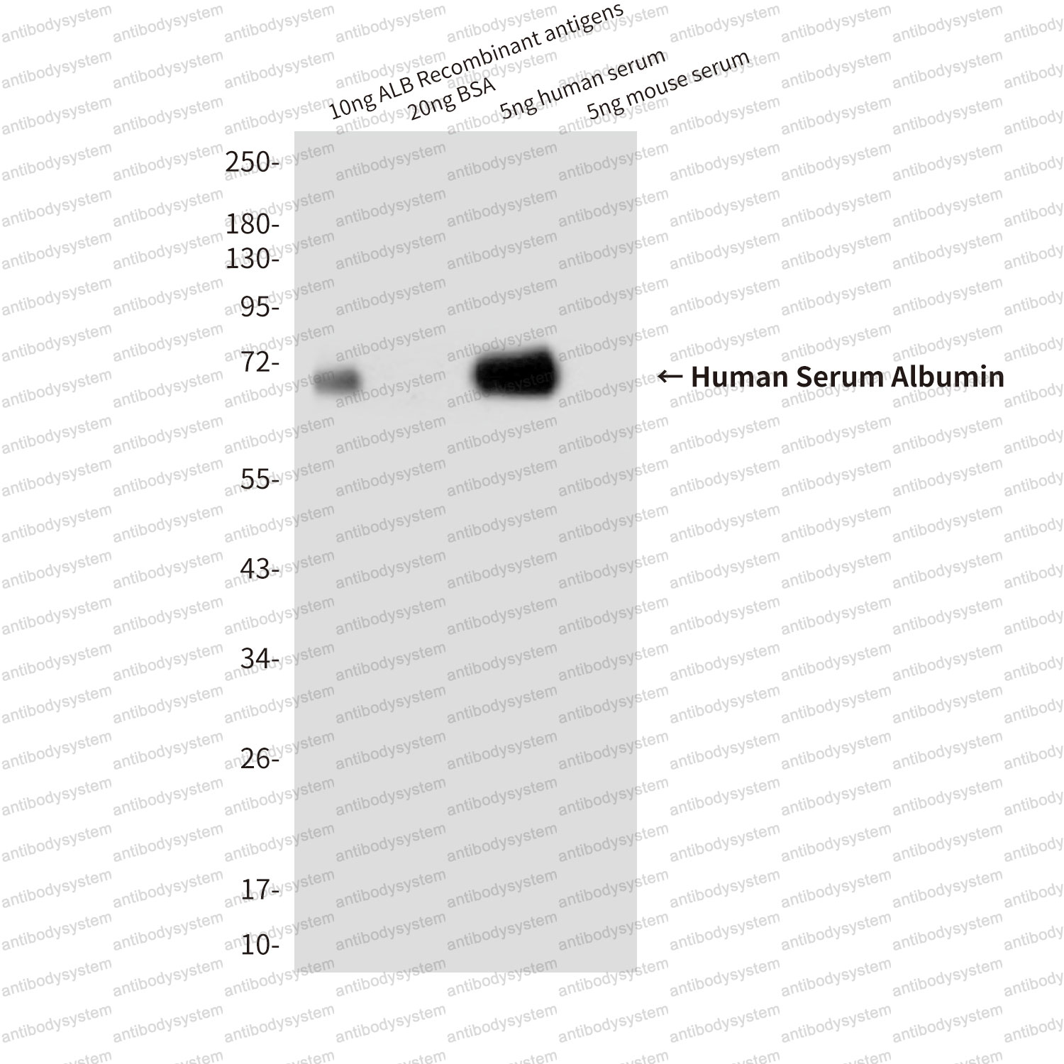 Anti-ALB/Albumin/HSA Antibody (R2Y24)