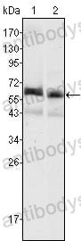 Anti-AFP/Alpha-fetoprotein Antibody (R2Y27)