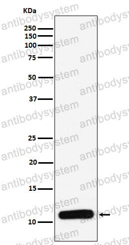 Anti-PF4/CXCL4 Antibody (R1J17)