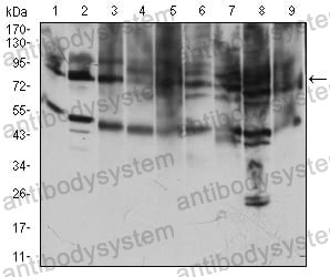 Anti-CD71/TFRC Antibody (R2Y29)