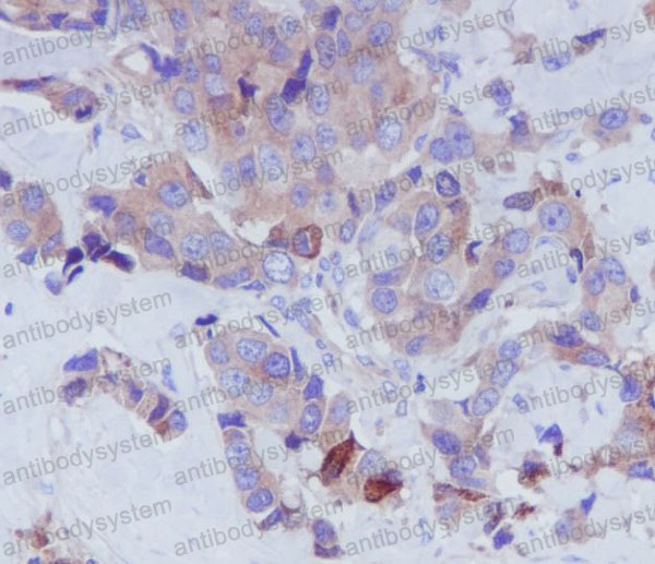 Anti-TF/Transferrin Antibody (R1B53)