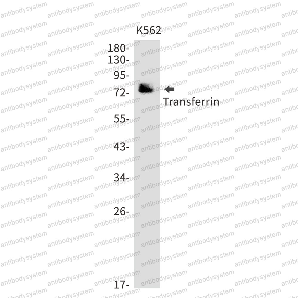 Anti-TF/Transferrin Antibody (R1J21)
