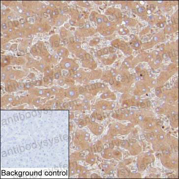 Anti-TF/Transferrin Antibody (R2Y30)