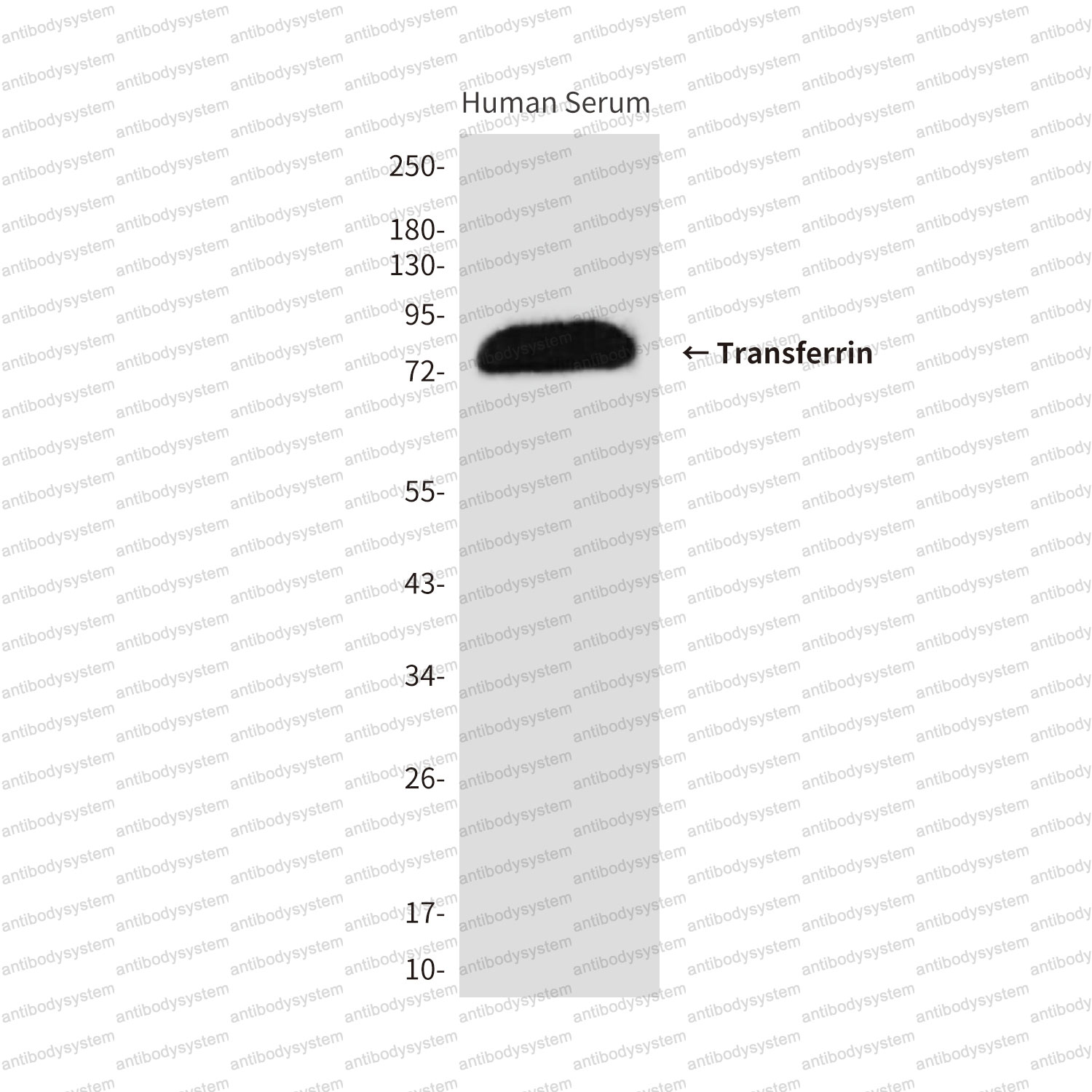 Anti-TF/Transferrin Antibody (R2Y31)