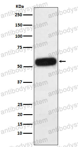 Anti-AHSG Antibody (R1J11)