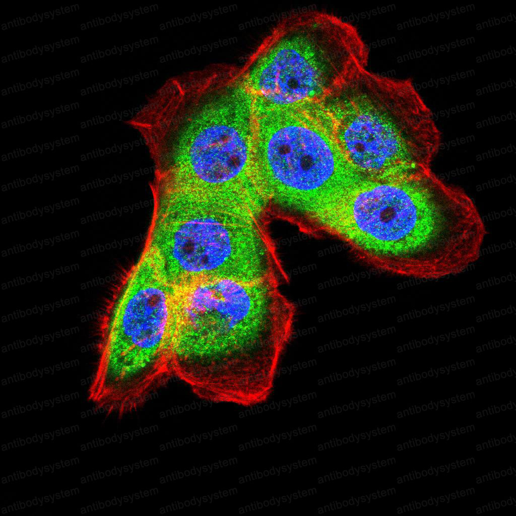Anti-FTL Antibody (R2Y33)