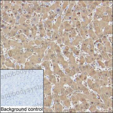 Anti-FTH1 Antibody (R2Y34)