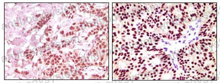 Anti-ESR1/ER-alpha Antibody (R2Y35)
