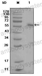 Anti-ESR1/ER-alpha Antibody (R2Y37)