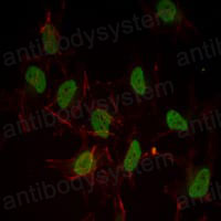 Anti-ESR1/ER-alpha Antibody (R2Y38)
