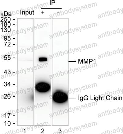 Anti-MMP1 Antibody (R2Y42)