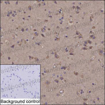 Anti-HMGCR Antibody (R2Y44)