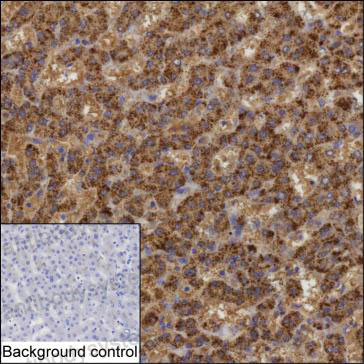 Anti-CAT/Catalase Antibody (R2Y45)