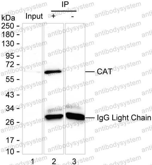 Anti-CAT/Catalase Antibody (R2Y46)