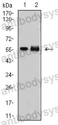 Anti-DNTT Antibody (R2Y48)