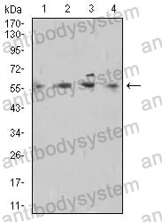 Anti-DNTT Antibody (R2Y49)