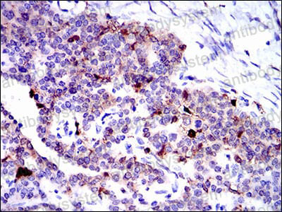 Anti-ANXA1/Annexin A1 Antibody (R2Y52)
