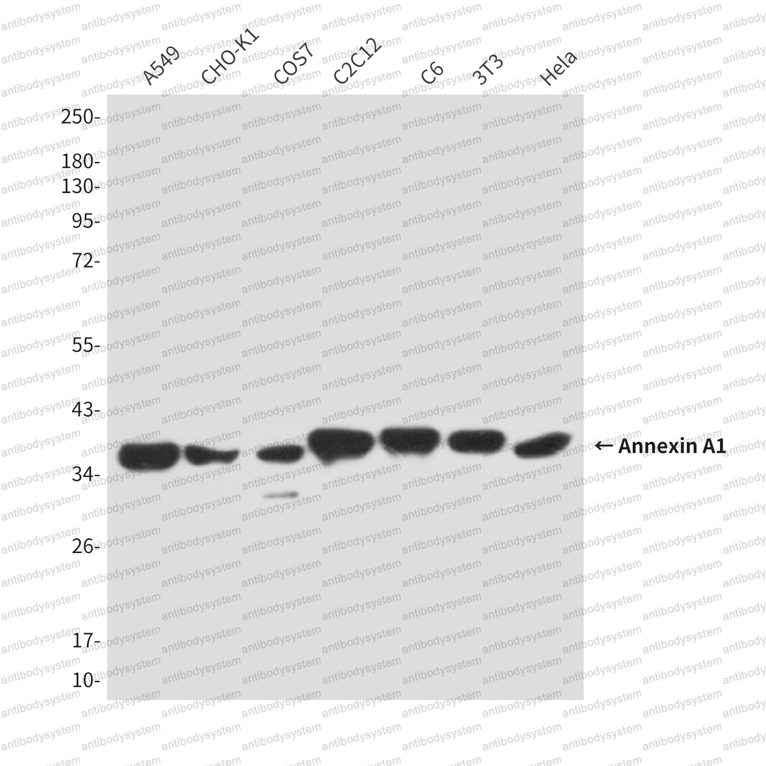 Anti-ANXA1/Annexin A1 Antibody (R2Y53)