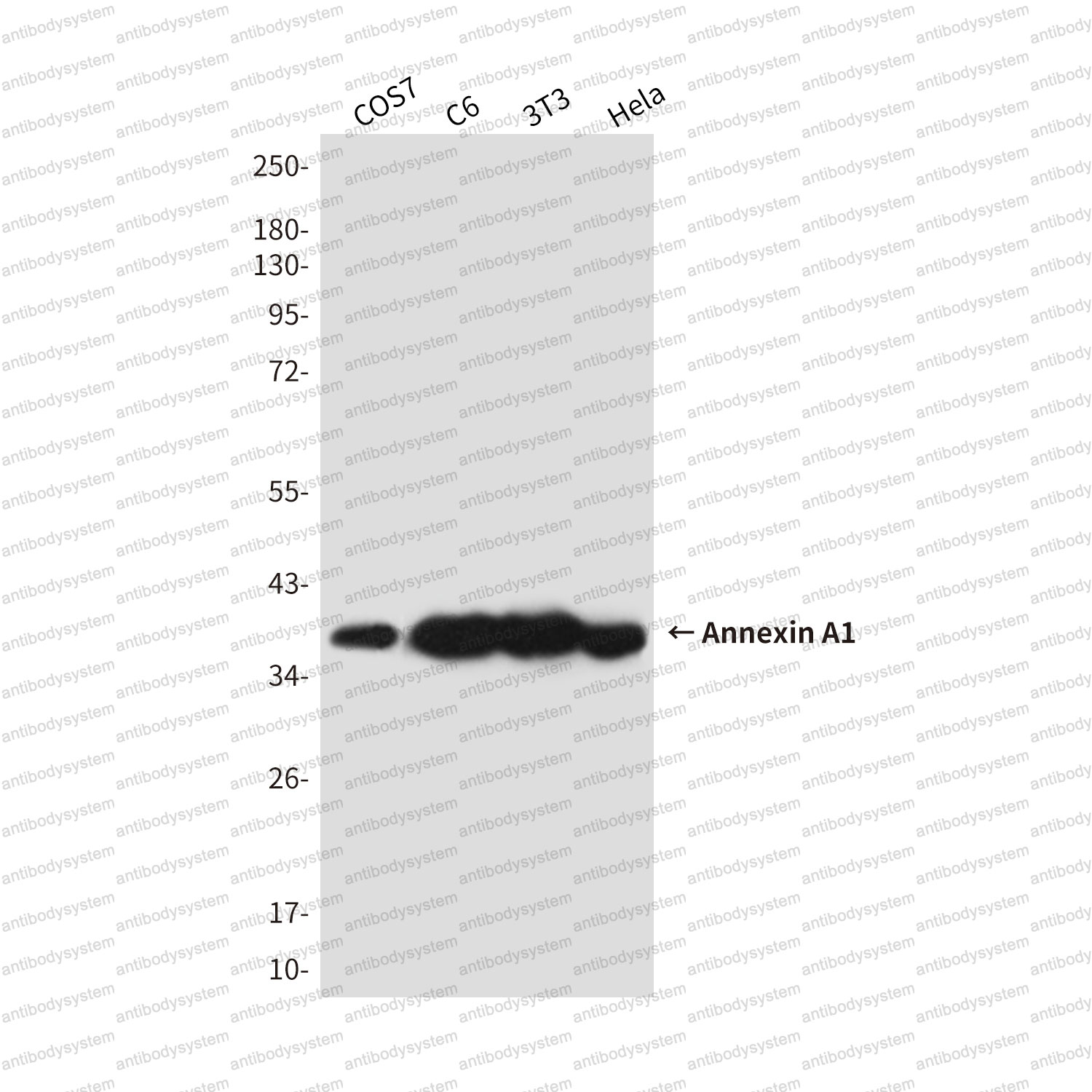 Anti-ANXA1/Annexin A1 Antibody (R2Y54)