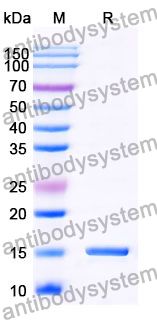 Anti-Human CD230/PRNP Nanobody (SAA0870)