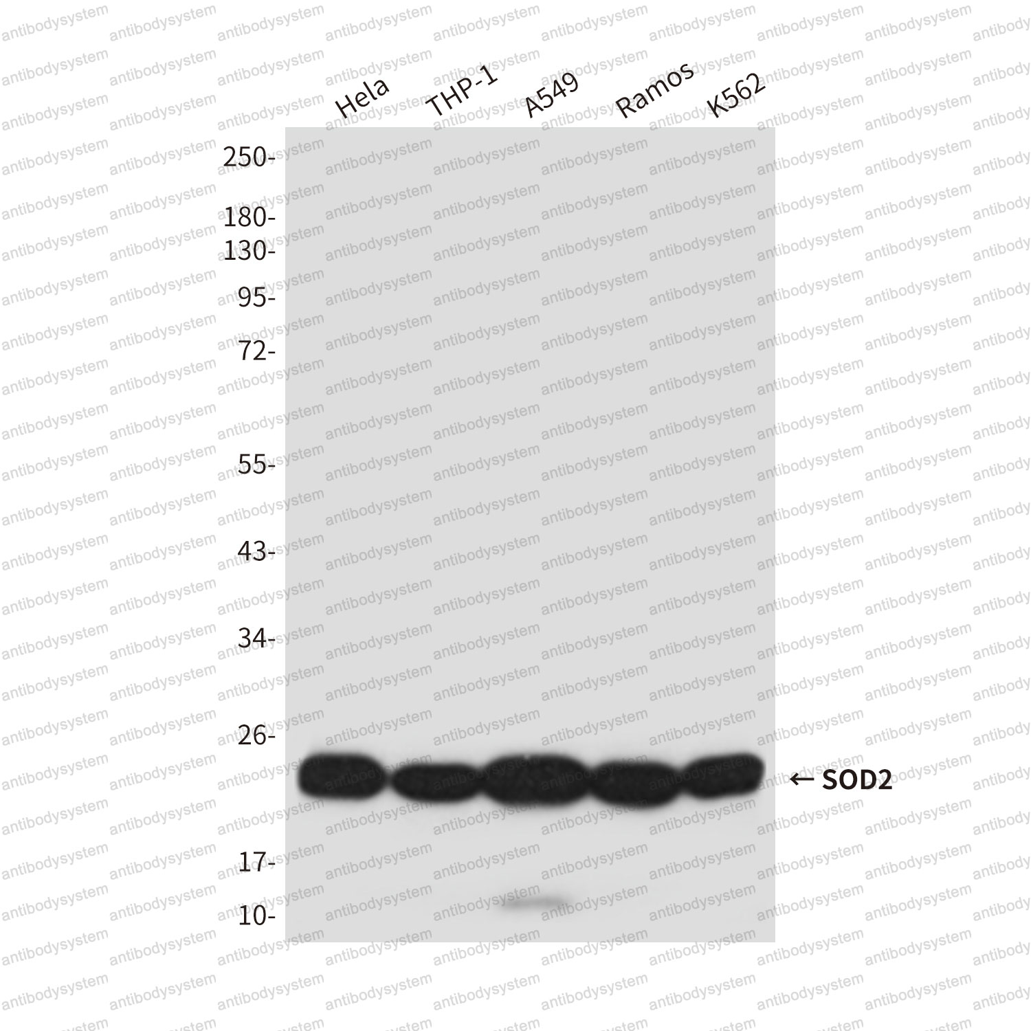 Anti-SOD2 Antibody (R2Y62)