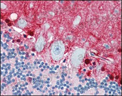 Anti-S100B Antibody (R2Y72)