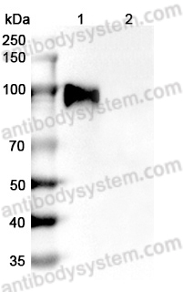 Anti-Human CD340/ERBB2/HER2 Antibody (SAA2012)