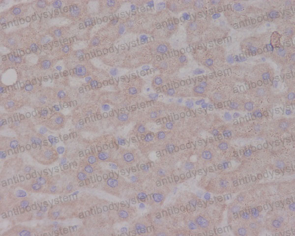 Anti-NTRK1/TRKA Antibody (R1B31)