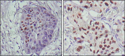 Anti-TP53/p53 Antibody (R2Y81)