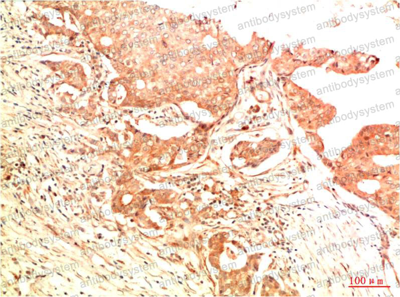 Anti-TP53/p53 Antibody (R2Y82)