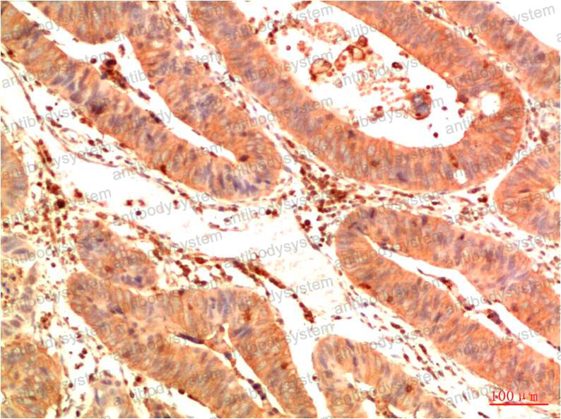 Anti-TP53/p53 Antibody (R2Y83)