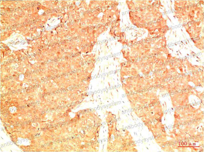 Anti-TP53/p53 Antibody (R2Y84)