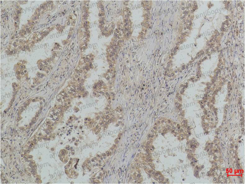 Anti-TP53/p53 Antibody (R2Y85)
