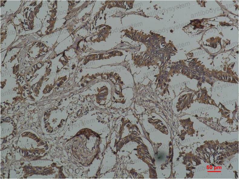 Anti-HSPB1/HSP27 Antibody (R2Y88)