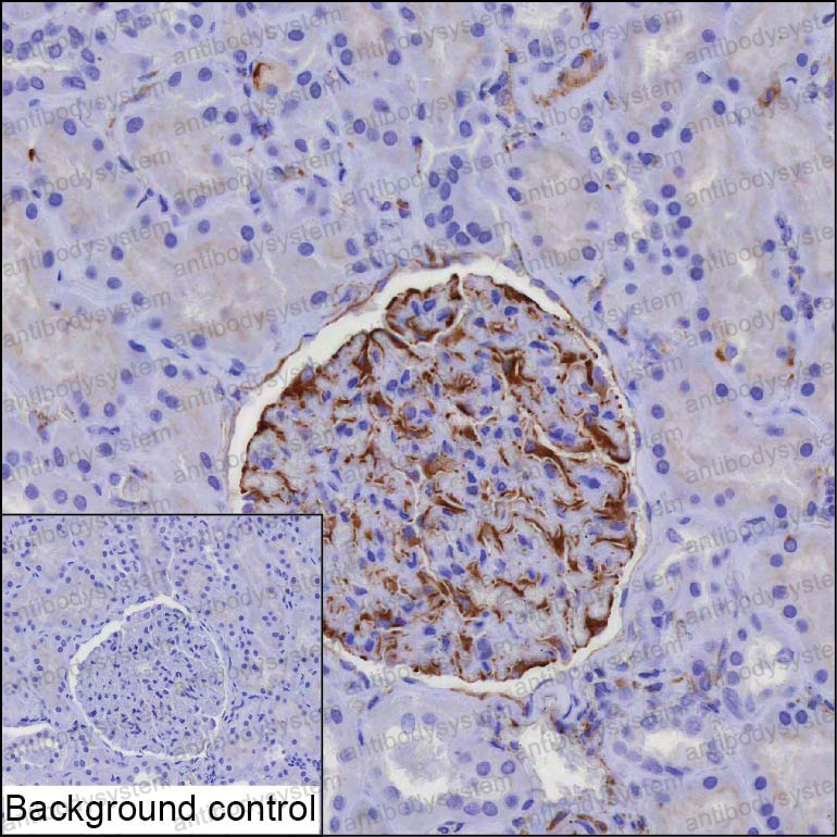 Anti-IGF1 Antibody (R2Y91)