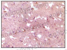Anti-APP Antibody (R2Y94)