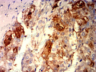 Anti-ARG1/Arginase-1 Antibody (R2Y97)