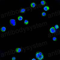 Anti-CD18/ITGB2 Antibody (R2Z03)