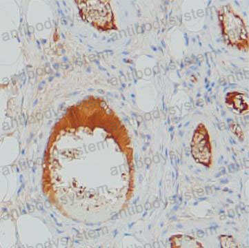 Anti-SERPING1 Antibody (R2Z09)