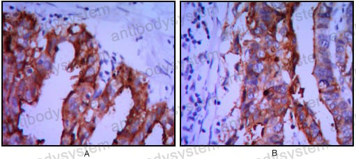 Anti-ALPP/PLAP Antibody (R2Z12)
