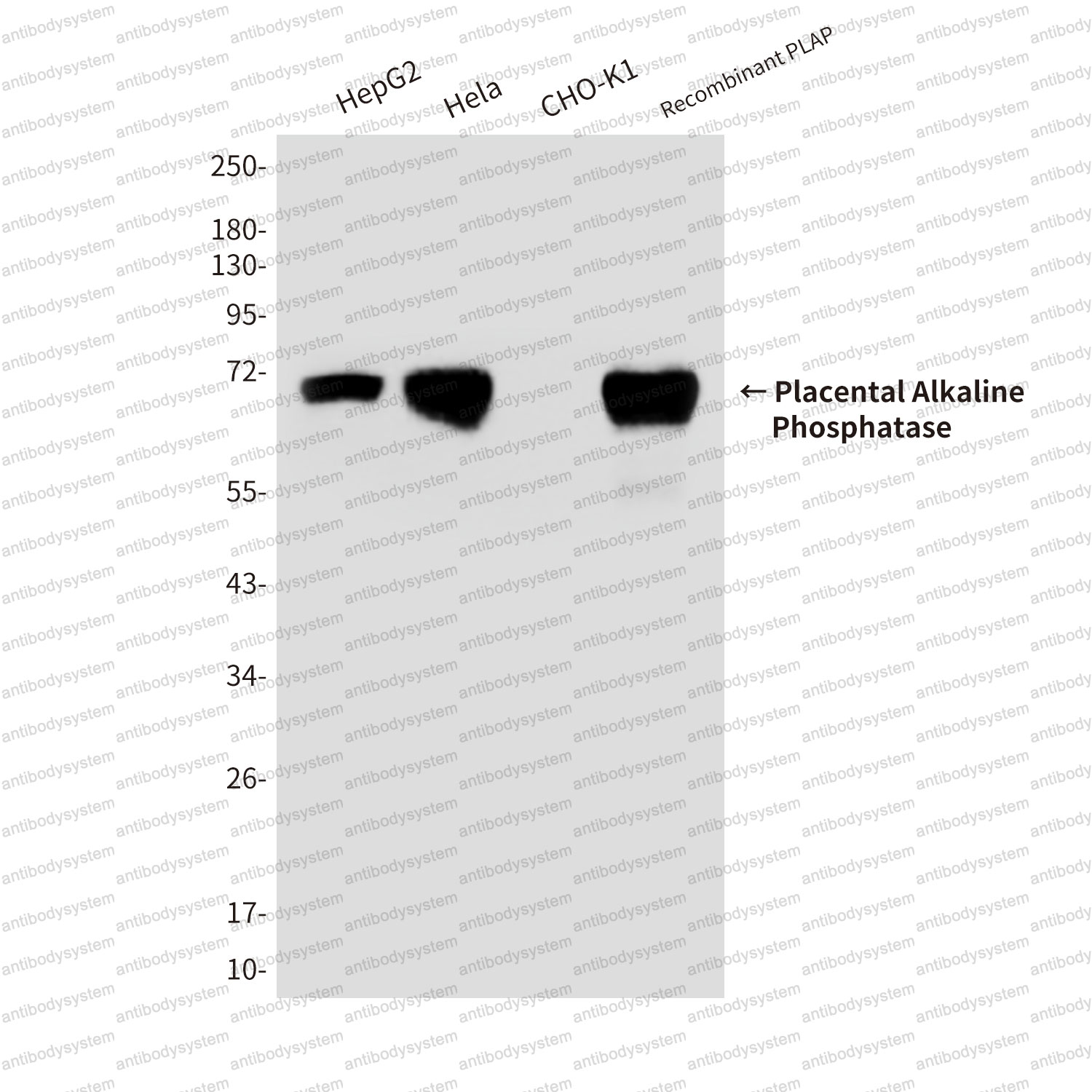 Anti-ALPP/PLAP Antibody (R2Z13)
