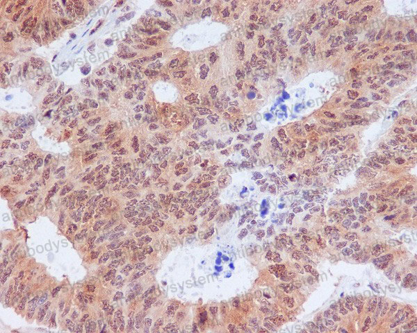 Anti-Phospho-EIF2S1 (Ser51) Antibody (R1A22)