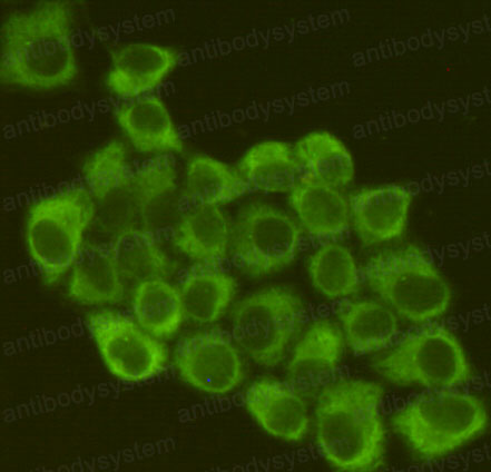 Anti-EIF2S1/eIF2A Antibody (R2Z15)