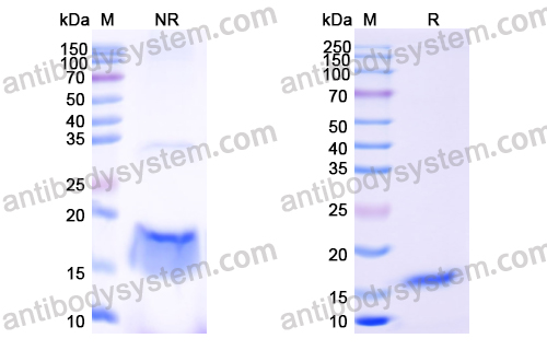 Anti-Human IL6 Nanobody (SAA0798)