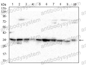 Anti-IL6 Antibody (R2Z16)